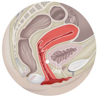 B-5 Extra(stem cell vaginoplasty, G-spot, Implant, PRP, L1) image 12
