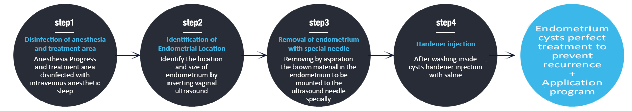 F-2 Endometrioma image 5